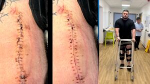 Blessure d'homme fort Blessure d'homme fort