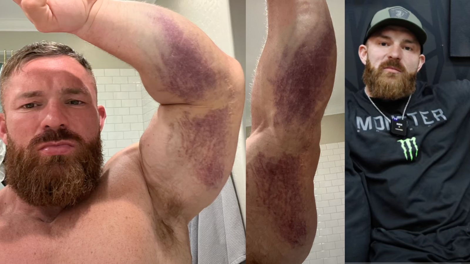7x 212 Olympia Flex Lewis déchire le tendon du triceps de l'os dans un accident « anormal », dit qu'il aura besoin d'une intervention chirurgicale – Fitness Volt