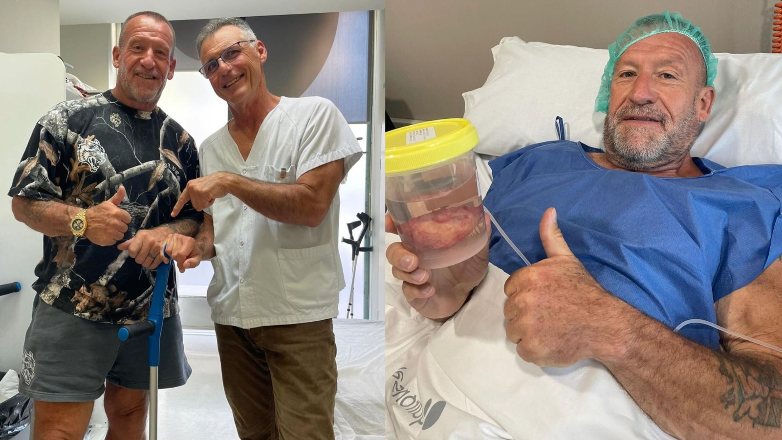 Dorian Yates fait le point sur sa santé 3 semaines après une arthroplastie de la hanche : "Je suis loin dans mon rétablissement" - Fitness Volt