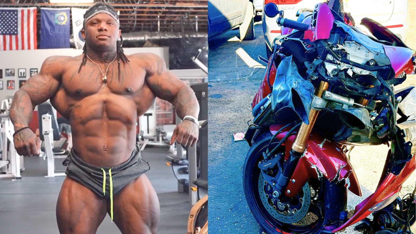 Graphique : Le bodybuilder Tonio Burton impliqué dans un accident de moto montre des blessures horribles – Fitness Volt