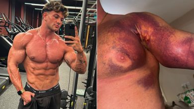 Déchirure brutale de Pec de Tristan Barnes: deux chirurgies, les revers et le côté obscur de la musculation - Fitness Volt