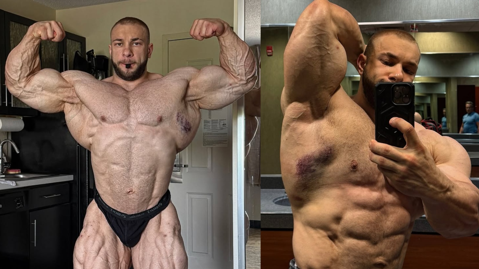 Ugolnikov 'Good Vito' Vitalii se retire de 2025 Pittsburgh Pro après avoir blessé le dos - Fitness Volt