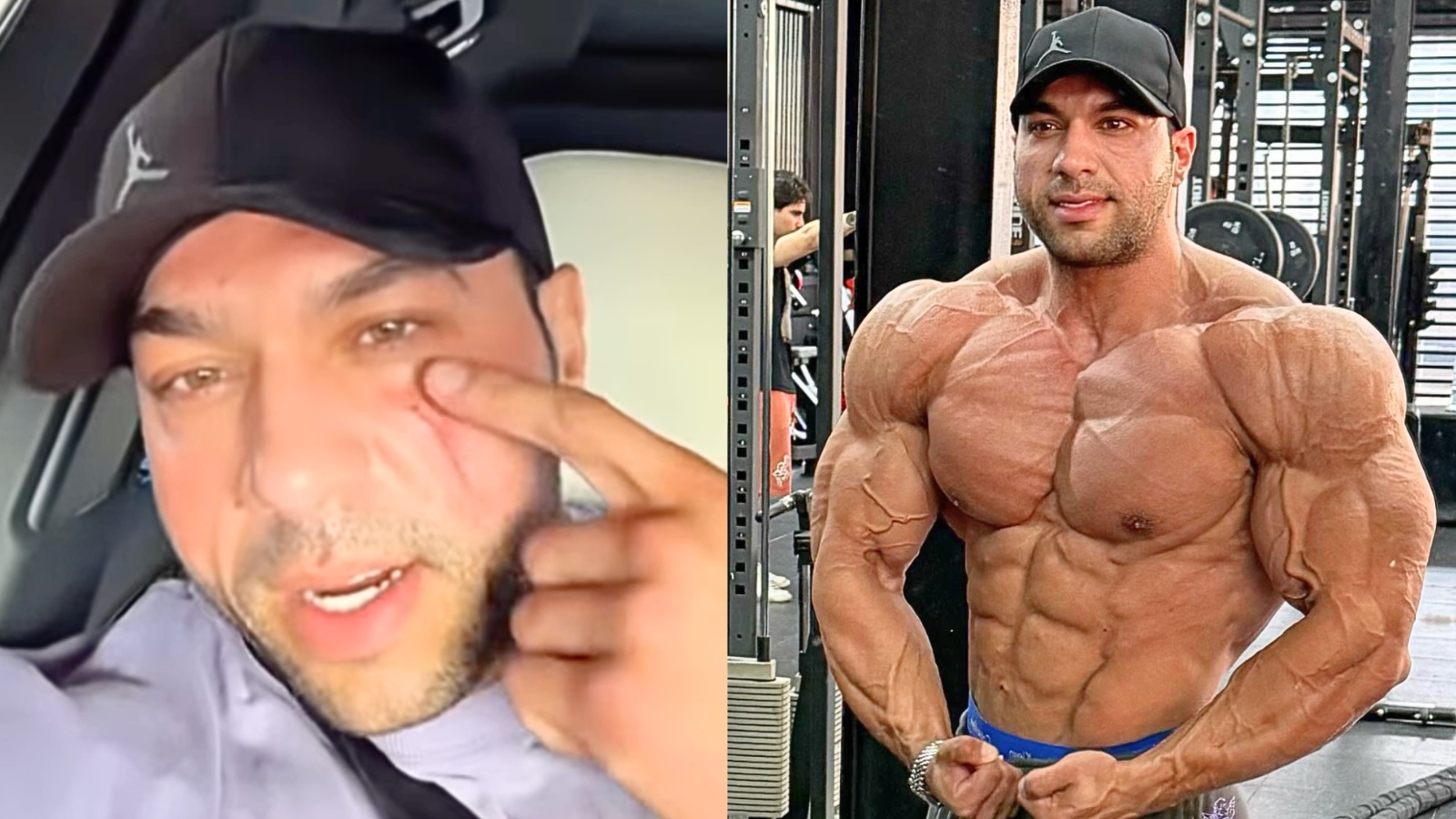 Le bodybuilder Michael Daboul dit «quelqu'un a tenté de me tuer» et montre une cicatrice de 16 points sur le visage - Fitness Volt