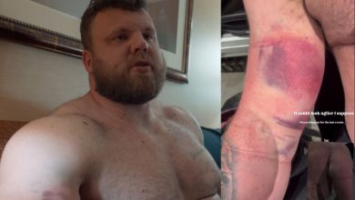 Tom Stoltman révèle une blessure au bicep