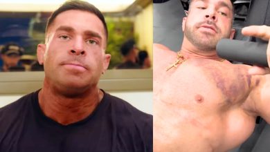 Derek Lunsford révèle qu'il s'est déchiré la poitrine 4 semaines avant de récupérer le titre à 2025 Mr. Olympia – Fitness Volt