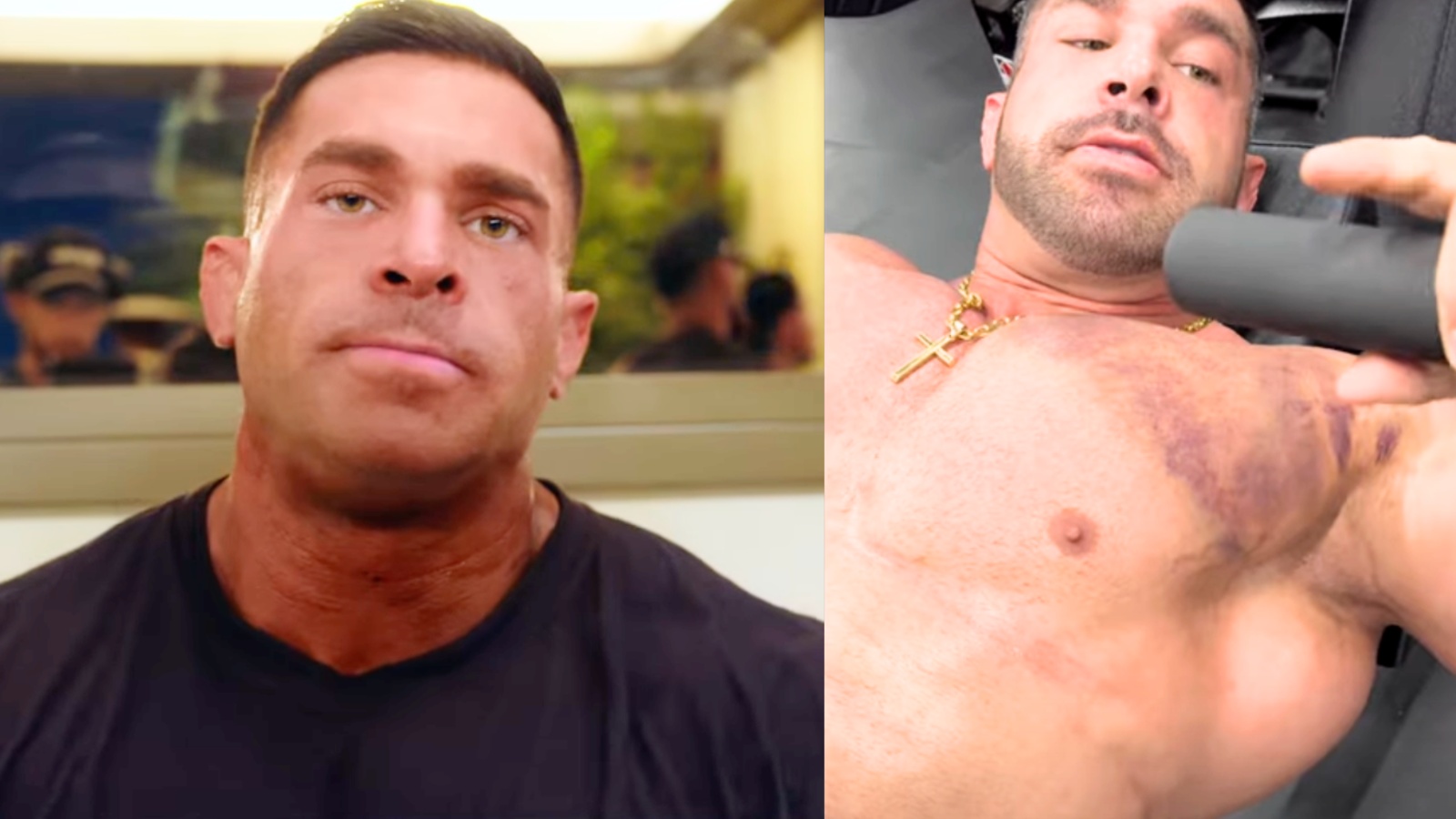 Derek Lunsford révèle qu'il s'est déchiré la poitrine 4 semaines avant de récupérer le titre à 2025 Mr. Olympia – Fitness Volt