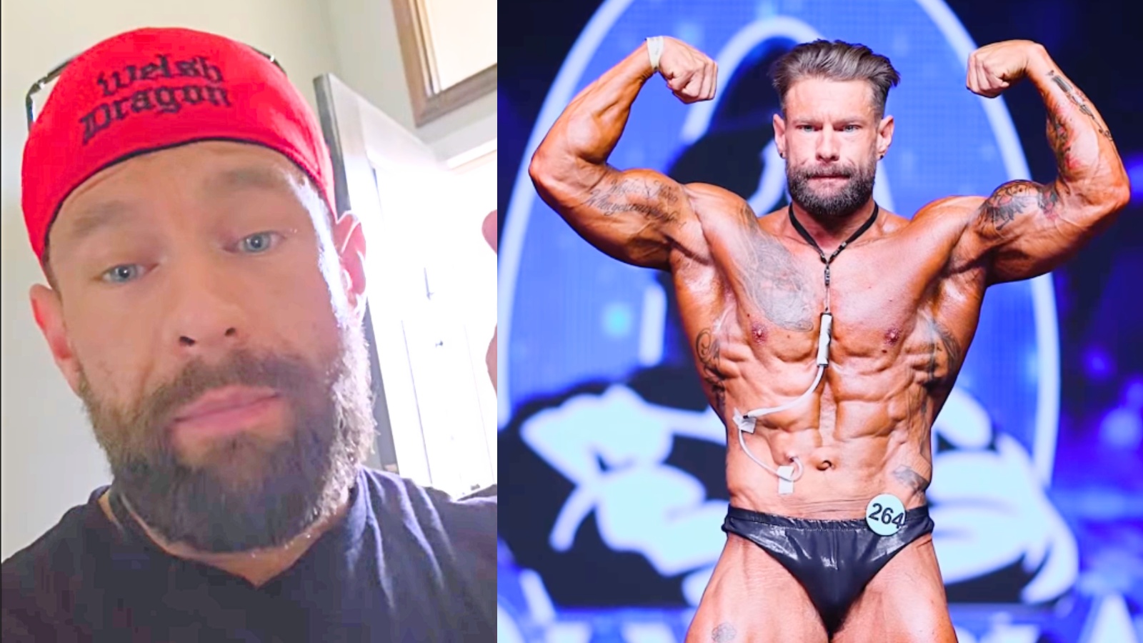 Un bodybuilder souffrant d’insuffisance rénale inspire après avoir participé à des spectacles consécutifs – Fitness Volt